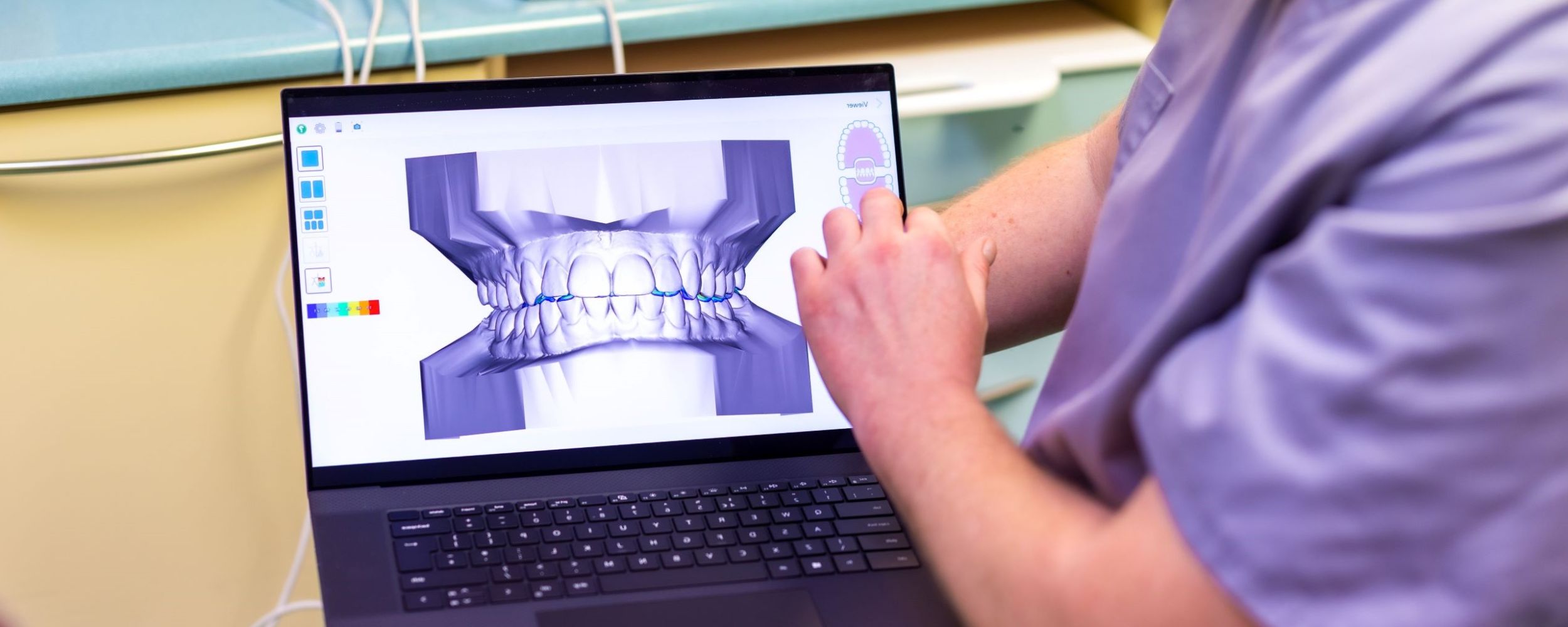 Broken teeth