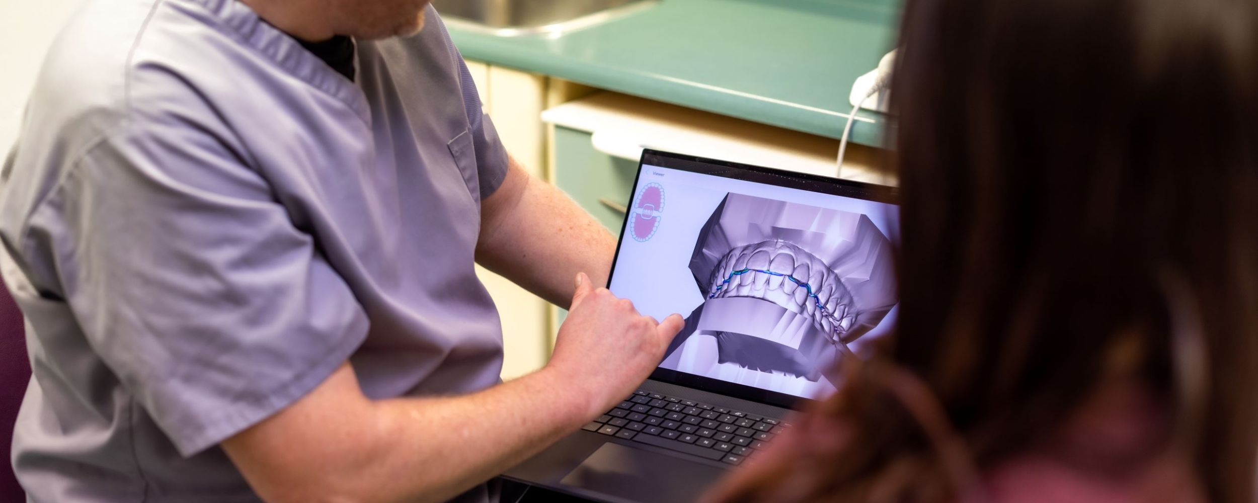 Invisalign clear aligners. 
